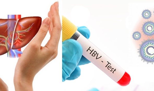 Xét nghiệm HBV DNA-126
