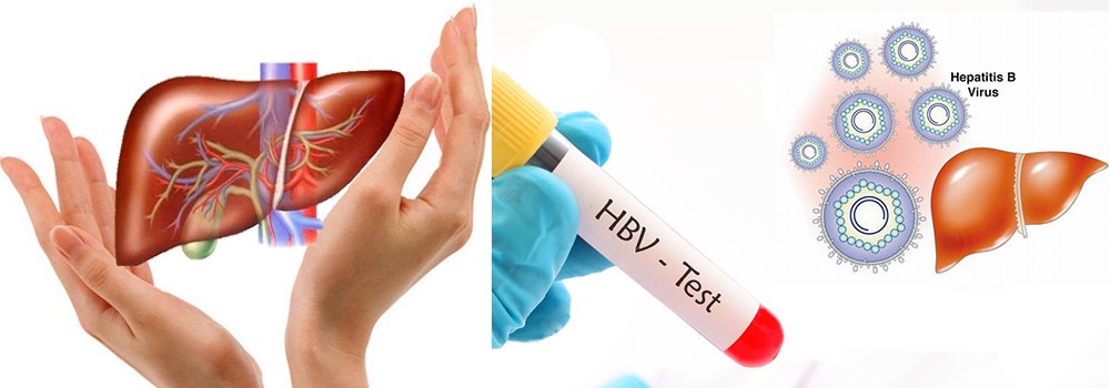 Xét nghiệm định lượng HBV DNA, Xét nghiệm định lượng HBV DNA